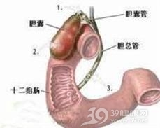 十二指肠内瘘