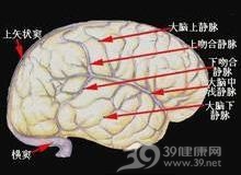 上矢状窦血栓性静脉炎