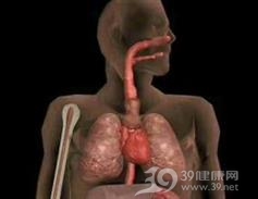 食物过敏性哮喘