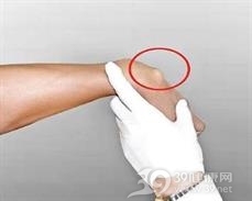手腕腱鞘囊肿