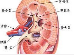 肾血管畸形与压迫