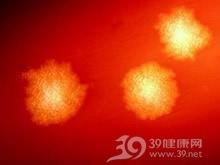 梭状芽胞杆菌伤口感染