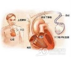 束支折返性室性心动过速