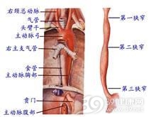 Turcot综合征