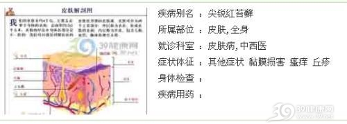 苔藓样念珠状疹