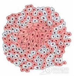 胃肠道伴癌综合征