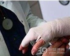 无机碱皮肤损伤