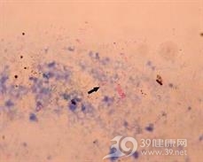 腺病毒性肠炎