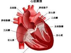 心包转移瘤
