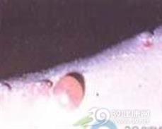 小儿慢性大疱性疾病