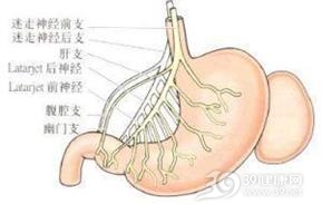 血管活性肠肽瘤
