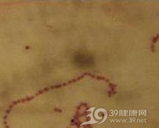 细菌协同性坏疽