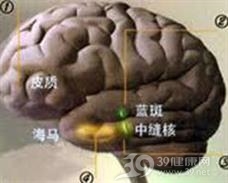 下丘脑多汗症