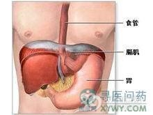 先天性食管憩室