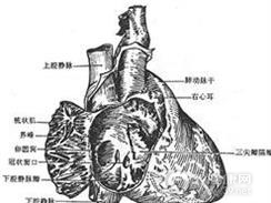 先天性心包缺如或缺损