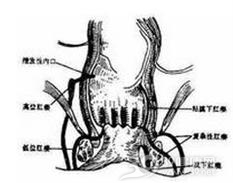 先天性直肠与周围脏器瘘