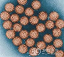 星形病毒胃肠炎
