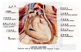 心脏转移瘤