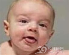 婴儿肌纤维瘤病