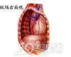 原发性纵隔感染