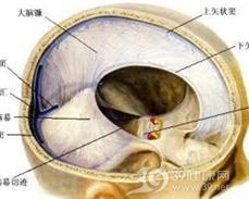 硬脑膜外血肿