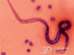 阴囊丝虫病