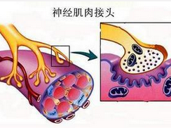 纵隔副神经节起源的肿瘤