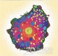 自由生活阿米巴感染